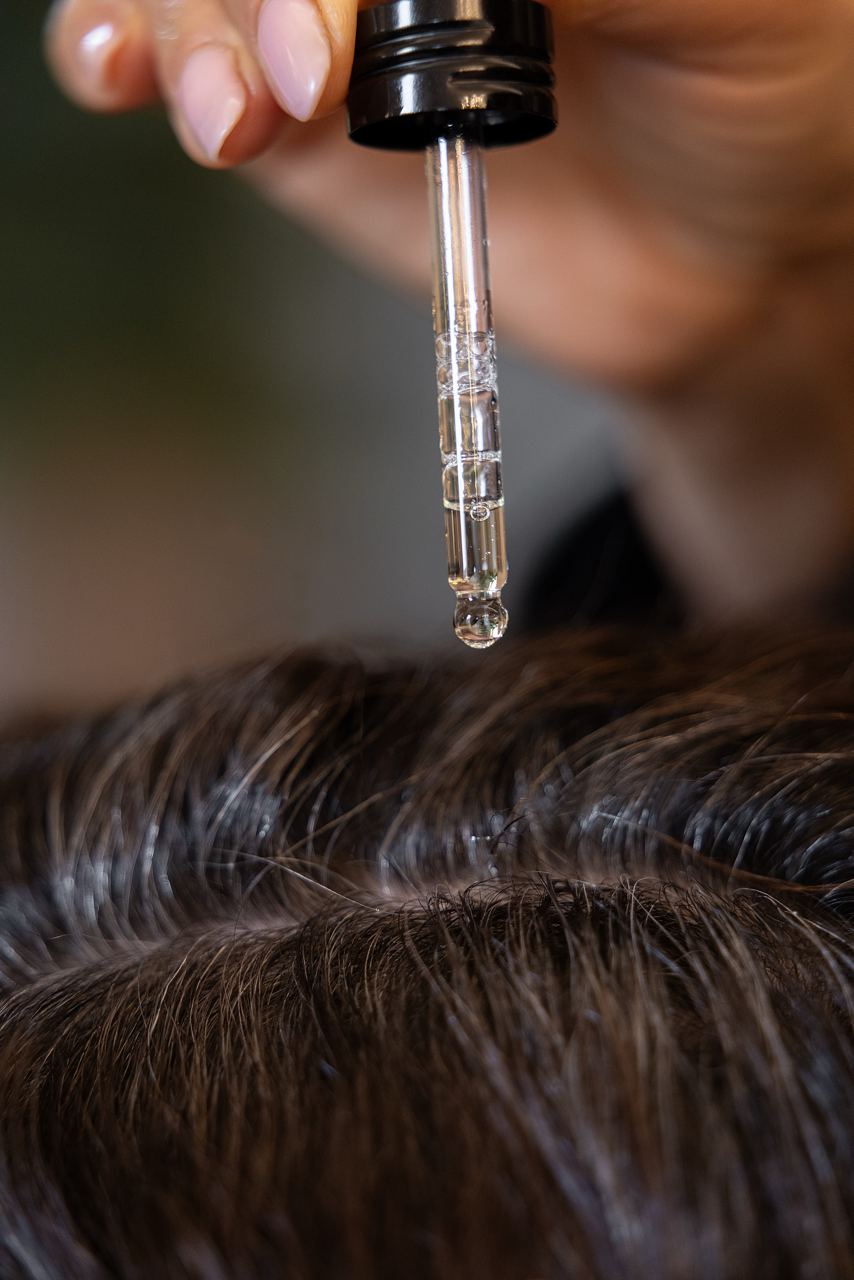 dandruff remedy - oily scalps